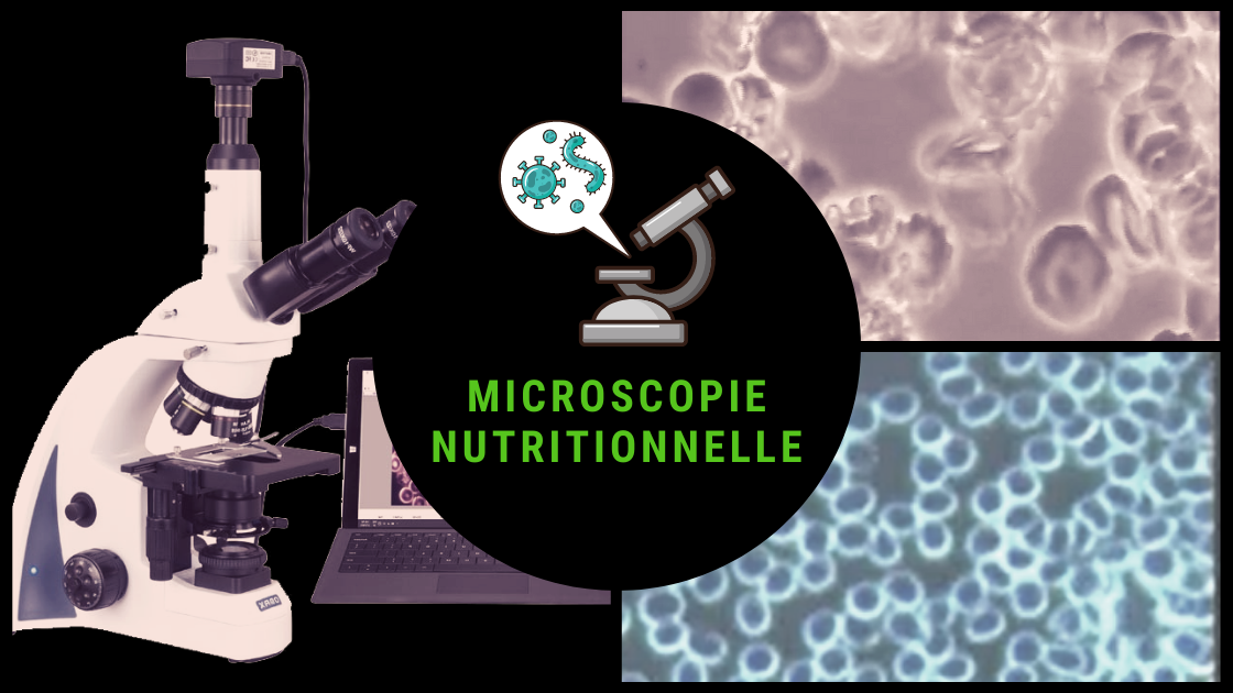 microscopie nutritionnelle ou analyse de cellules vivantes