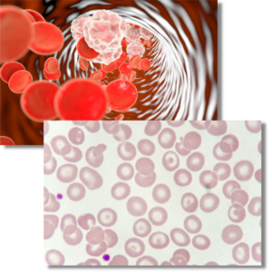 globules rouges dans le sang delafaye naturopathe analyse de sang vivant globules rouges dans le sang delafaye naturopathe analyse de sang vivant